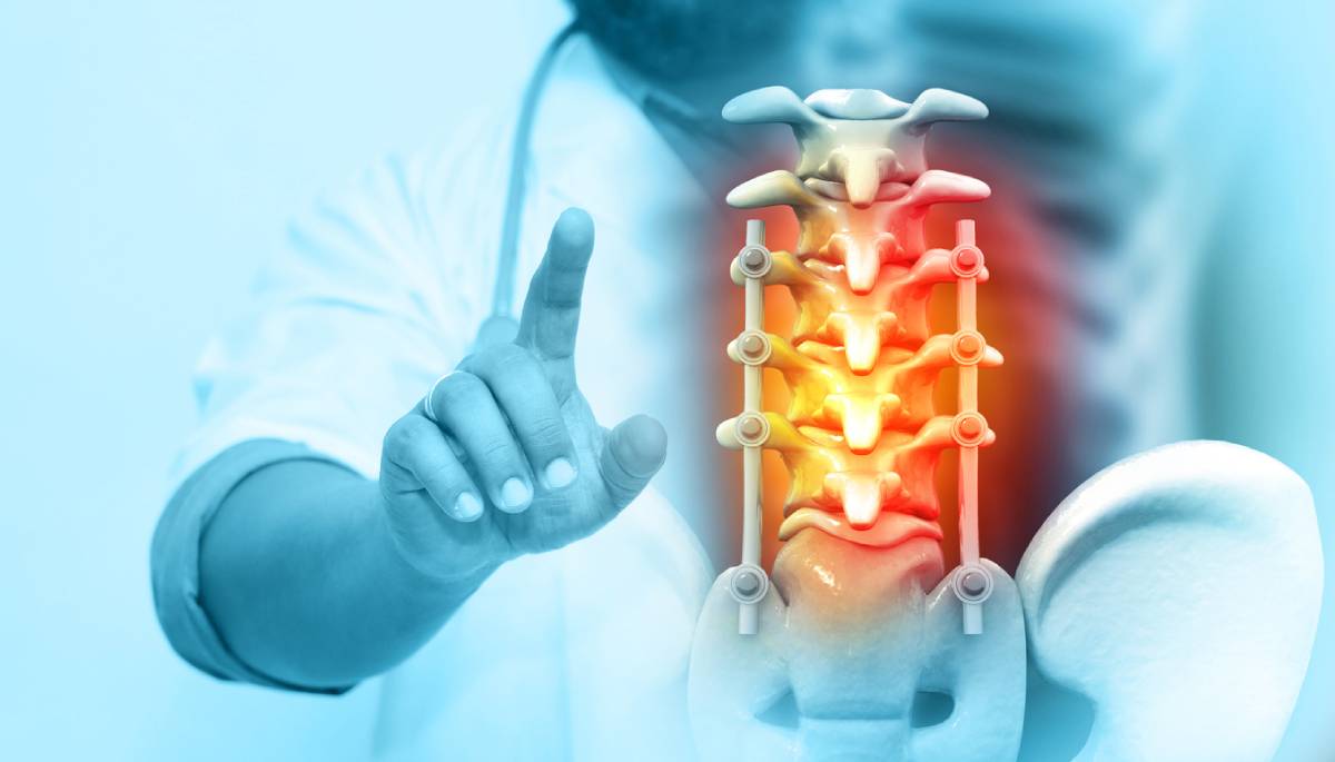 doctor example working on debunking 4 myths about spinal stenosis