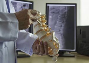 doctor holding up artificial spin
