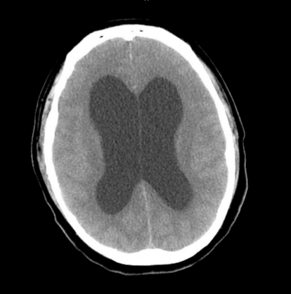 CT-scan Image1