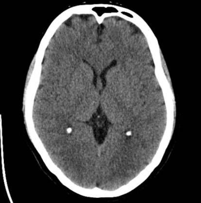 CT-scan Image2