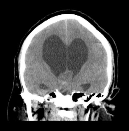 CT-scan Image3