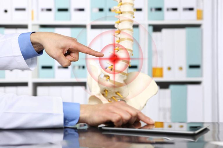 can-a-herniated-disc-heal-itself-yashar-neurosurgery-blog