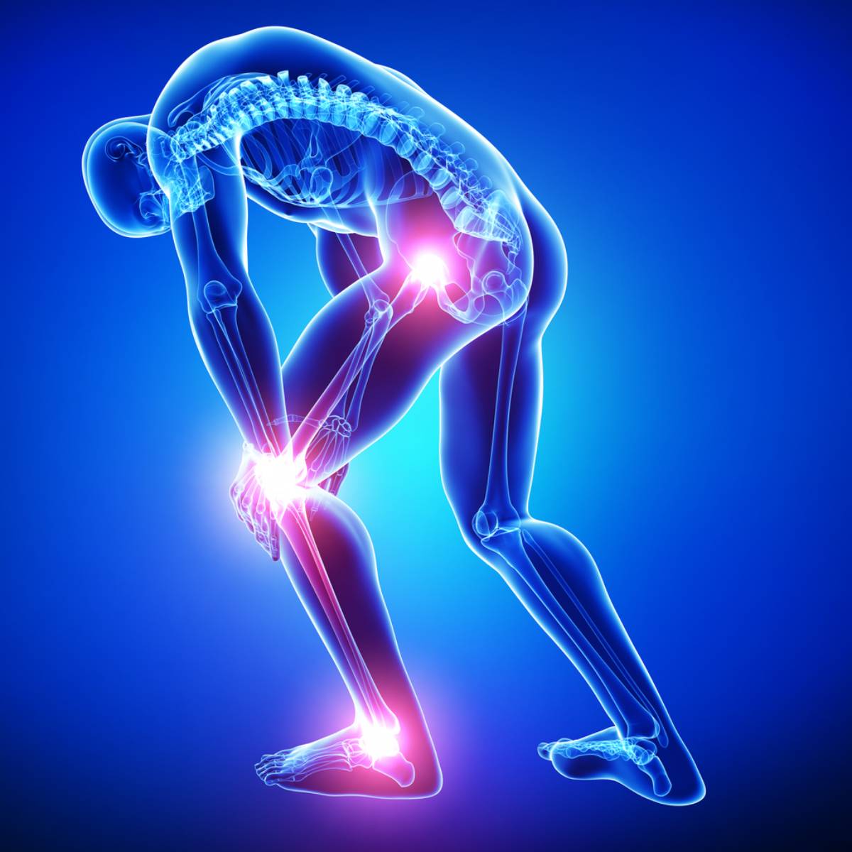 Man in pain from losing cartilage concept image